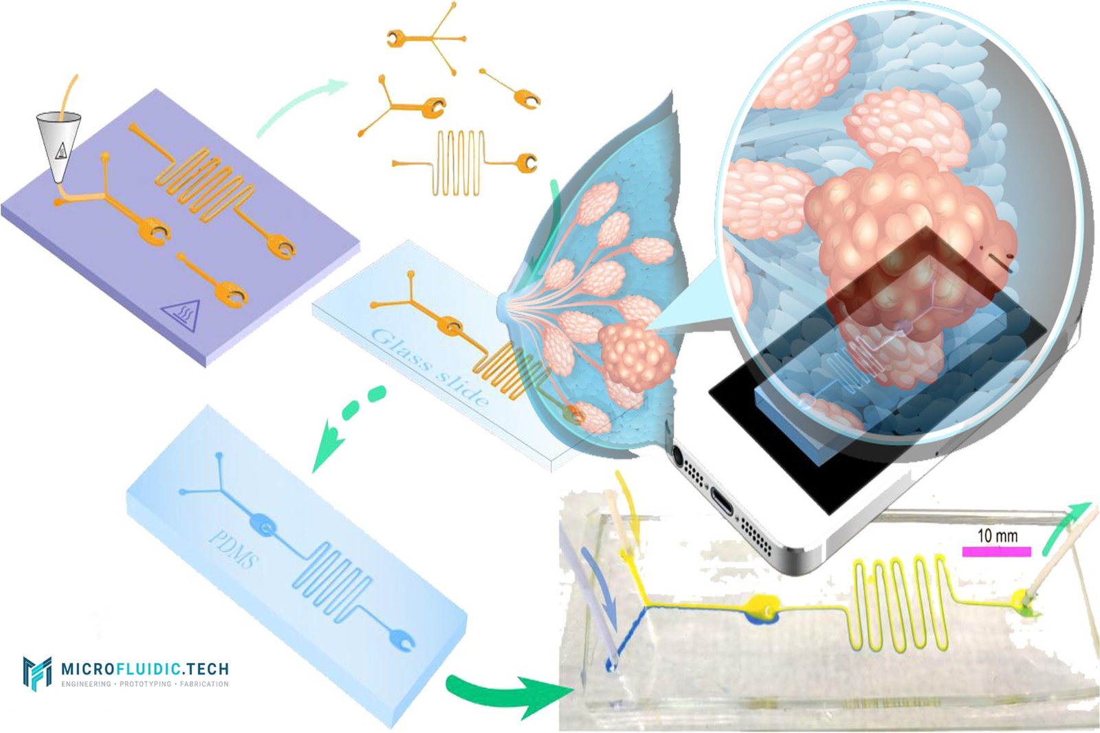 The Role of Microfluidics in Next-Generation Breast Cancer Therapies